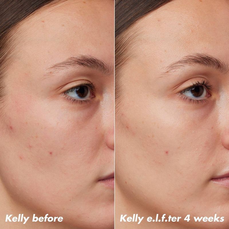 slide 4 of 14, e.l.f. SKIN PLZ Clarify Facial Oil - 2% Salicylic Acid Acne Treatment + Aloe Extract - 1 fl oz, 1 fl oz