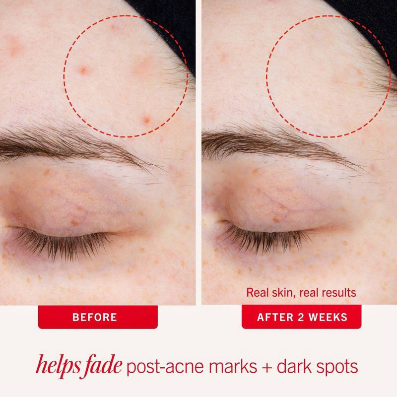 slide 3 of 9, FIRST AID BEAUTY Daily Resurfacing Moisturizer with 2% Niacinamide - 1 fl oz - Ulta Beauty, 1 fl oz