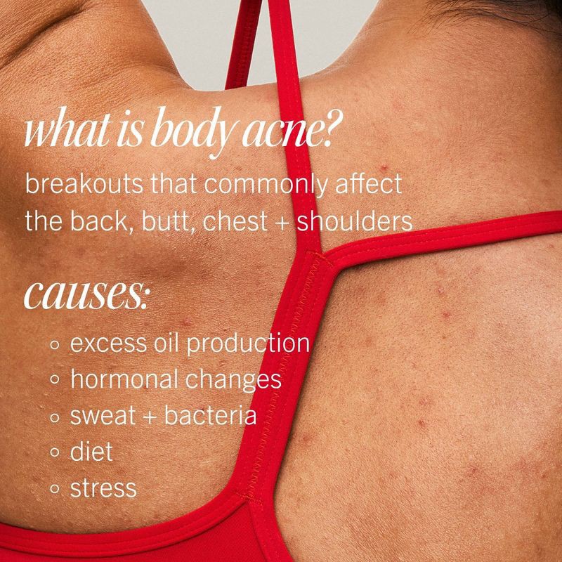 slide 10 of 10, FIRST AID BEAUTY Body Acne Clearing Mist with 2% Salicylic Acid - 3oz - Ulta Beauty, 3 oz