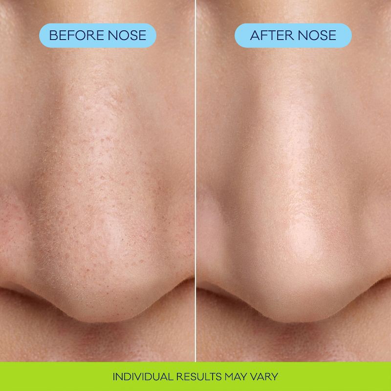 slide 4 of 11, Biore Bubbling Nose Mask - 8ct, 8 ct