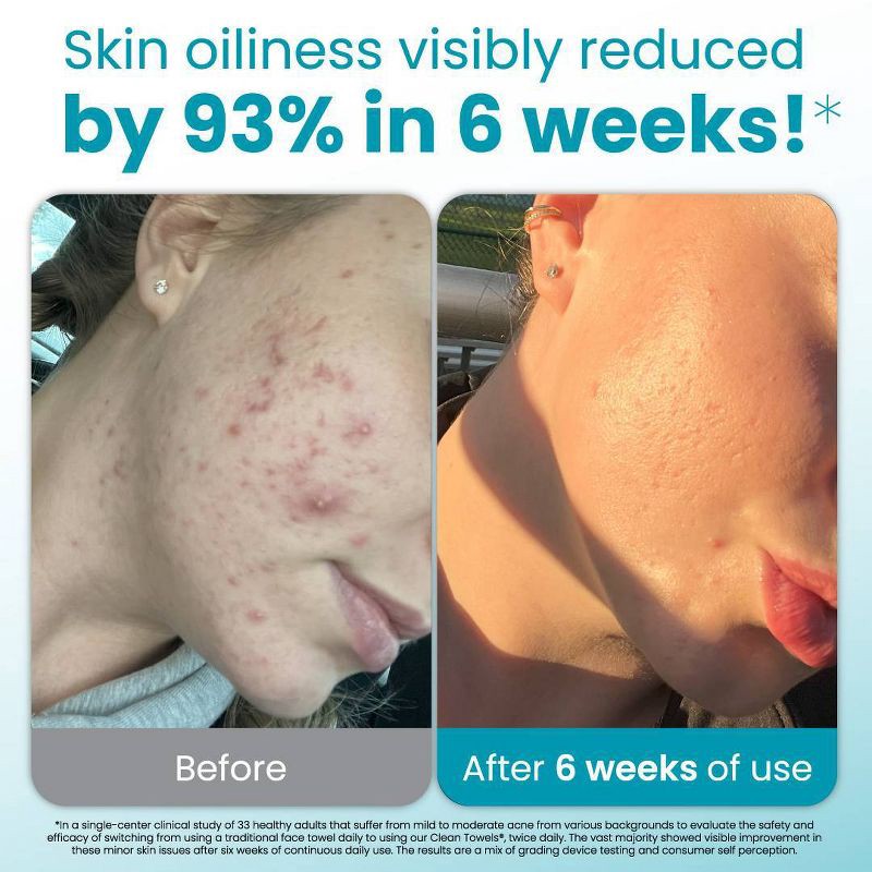 slide 3 of 10, Clean Skin Club Blemish Control Towels - XL - 10ct, 10 ct