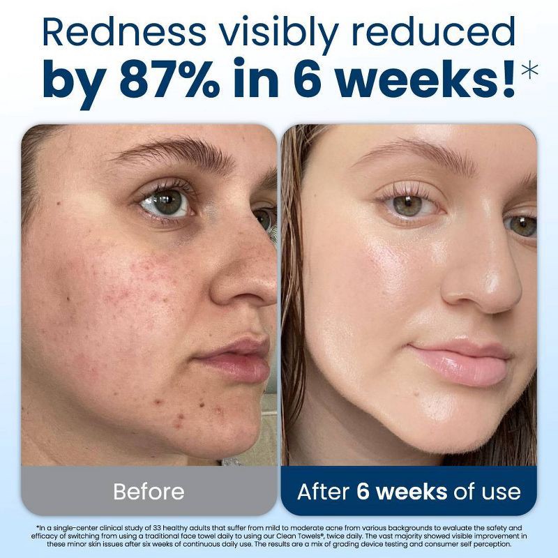 slide 6 of 11, Clean Skin Club Towels - 35ct, 35 ct