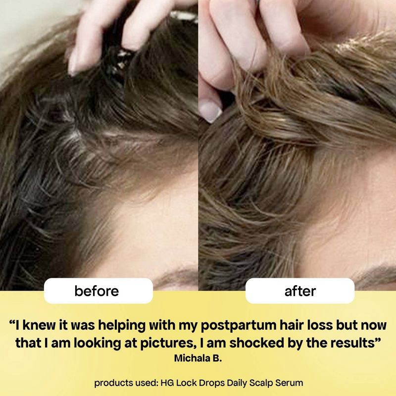 slide 3 of 8, Bondi Boost HG Lock Drops Daily Scalp Serum - 30ml - Ulta Beauty, 30 ml