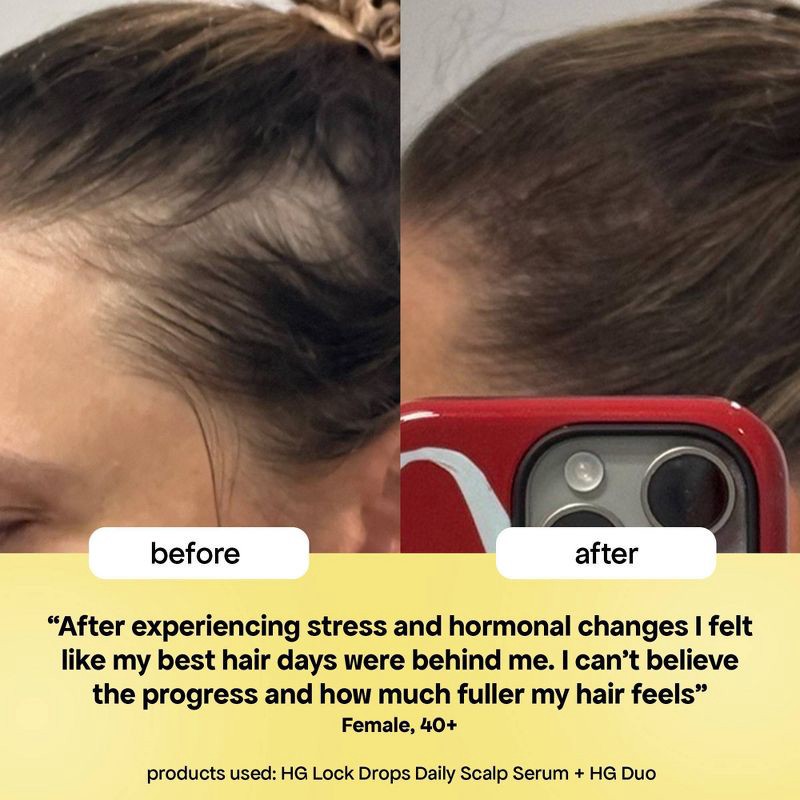 slide 4 of 8, Bondi Boost HG Lock Drops Daily Scalp Serum - 30ml - Ulta Beauty, 30 ml