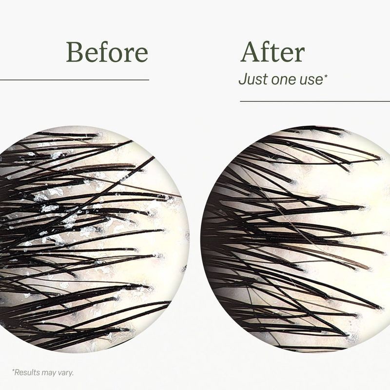 slide 3 of 6, Divi Scalp Reset Shampoo - Ulta Beauty, 1 ct