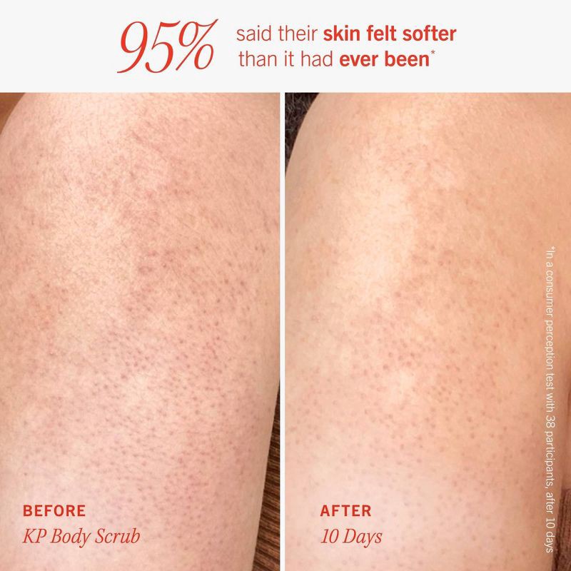 slide 3 of 6, FIRST AID BEAUTY Soft & Smooth Body Exfoliate Skincare Kit - 2ct - Ulta Beauty, 2 ct