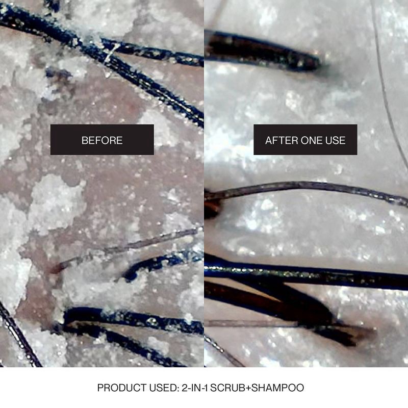 slide 11 of 12, NATURELAB. TOKYO Mainichi 2 in 1 Scalp Scrub and Clarifying Shampoo, 1 ct