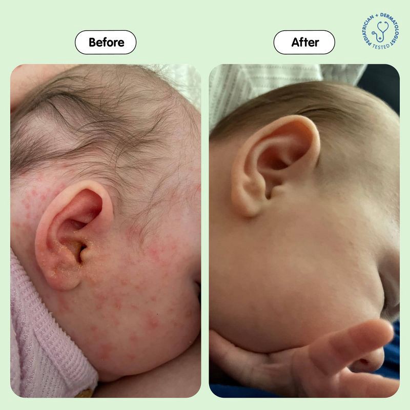 slide 5 of 9, Tubby Todd All Over Ointment Jar Fragrance Free - 8 oz, 8 oz