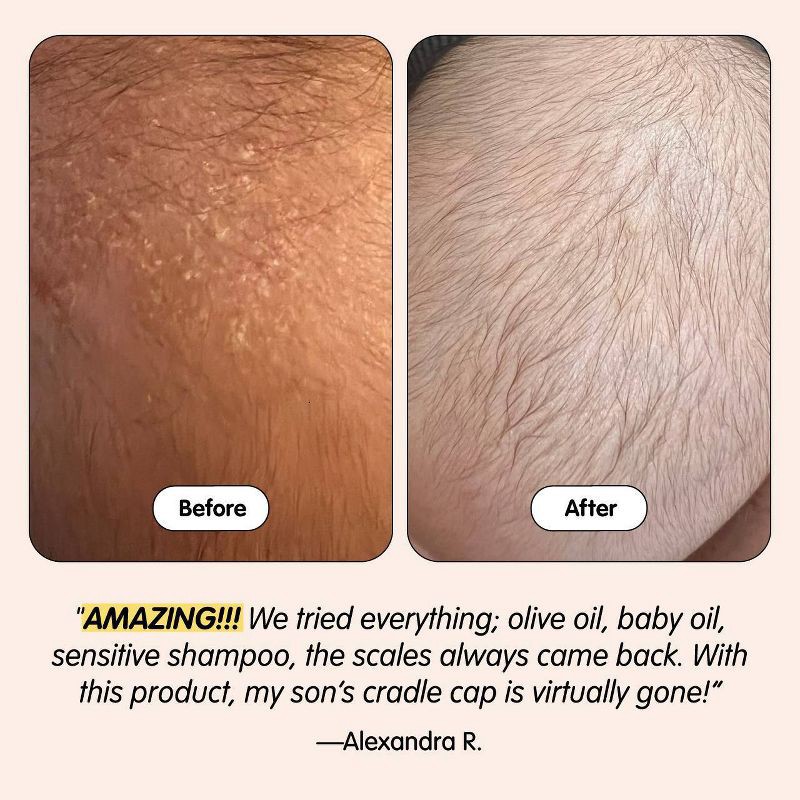 slide 3 of 5, Tubby Todd Cradle Cap 1.5 oz, 1.5 oz