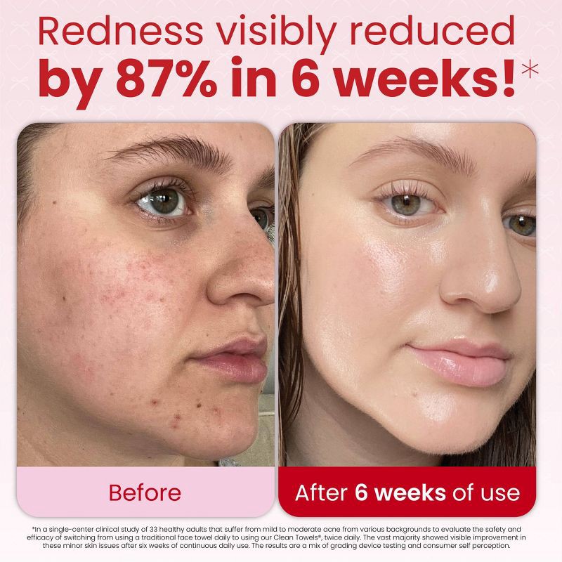 slide 5 of 10, Clean Skin Club Galentines Towels - 10ct, 10 ct