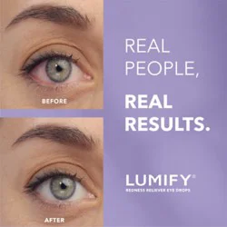 Lumify Redness Reliever Eye Drops Brimonidine Tartrate Ophthalmic Solution 0.025% - 0.25 Fl. Oz.