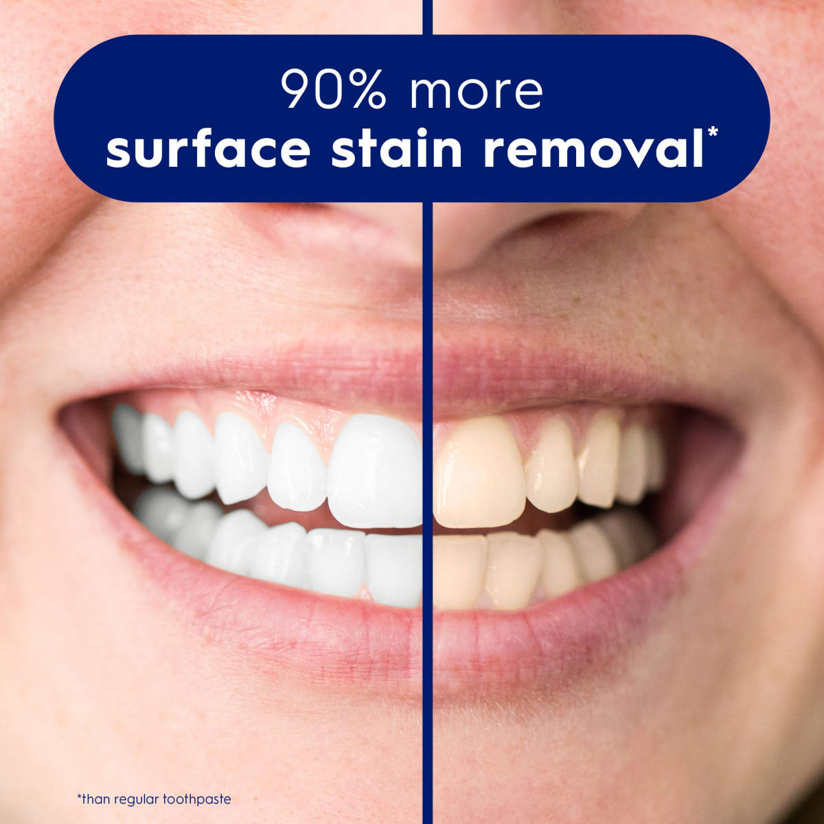 slide 16 of 29, Crest 3D White Advanced Glamorous Tw, 2 ct; 7.6 oz