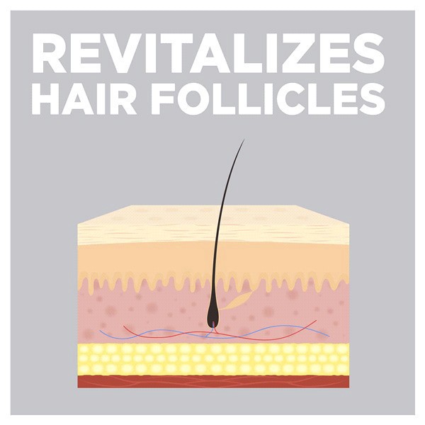 slide 11 of 29, Meijer Hair Regrowth Treatment For Women, Minoxidil Topical Solution, 2 Percent Bottles, 2 oz, 3 ct
