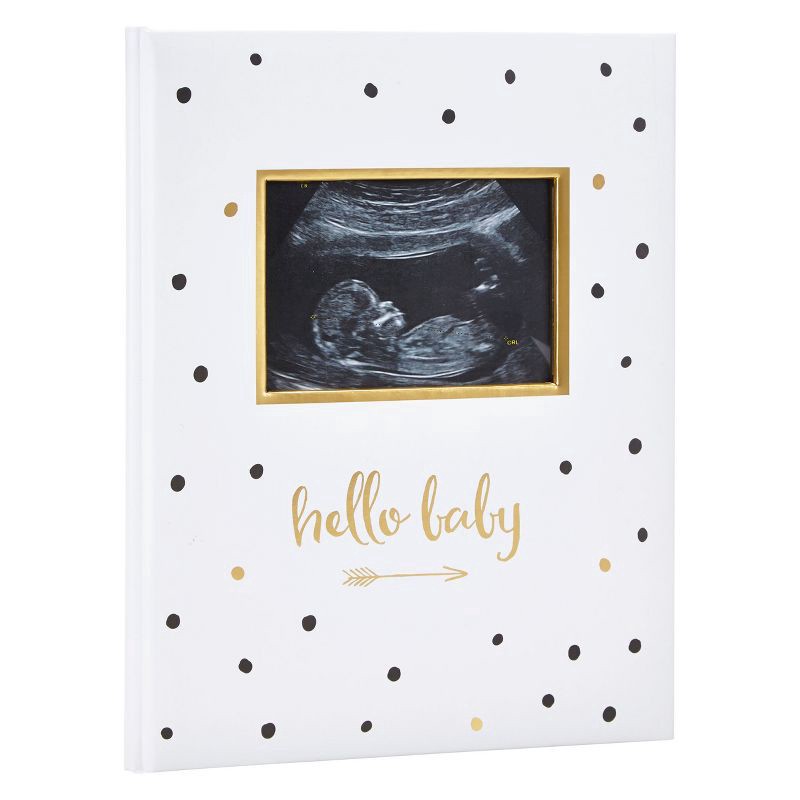 slide 1 of 9, Pearhead Hello Baby'' Sonogram Baby Memory Book, Black and Gold Polka Dots'', 1 ct