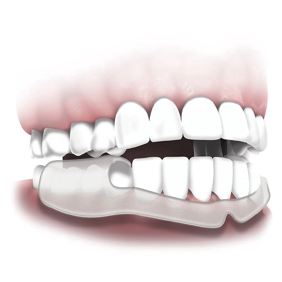 slide 2 of 4, Walgreens Ready to Wear Dental Guards, 16 ct