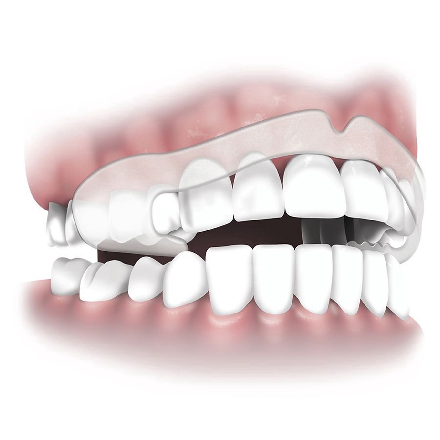 slide 3 of 4, Walgreens Ready to Wear Dental Guards, 16 ct