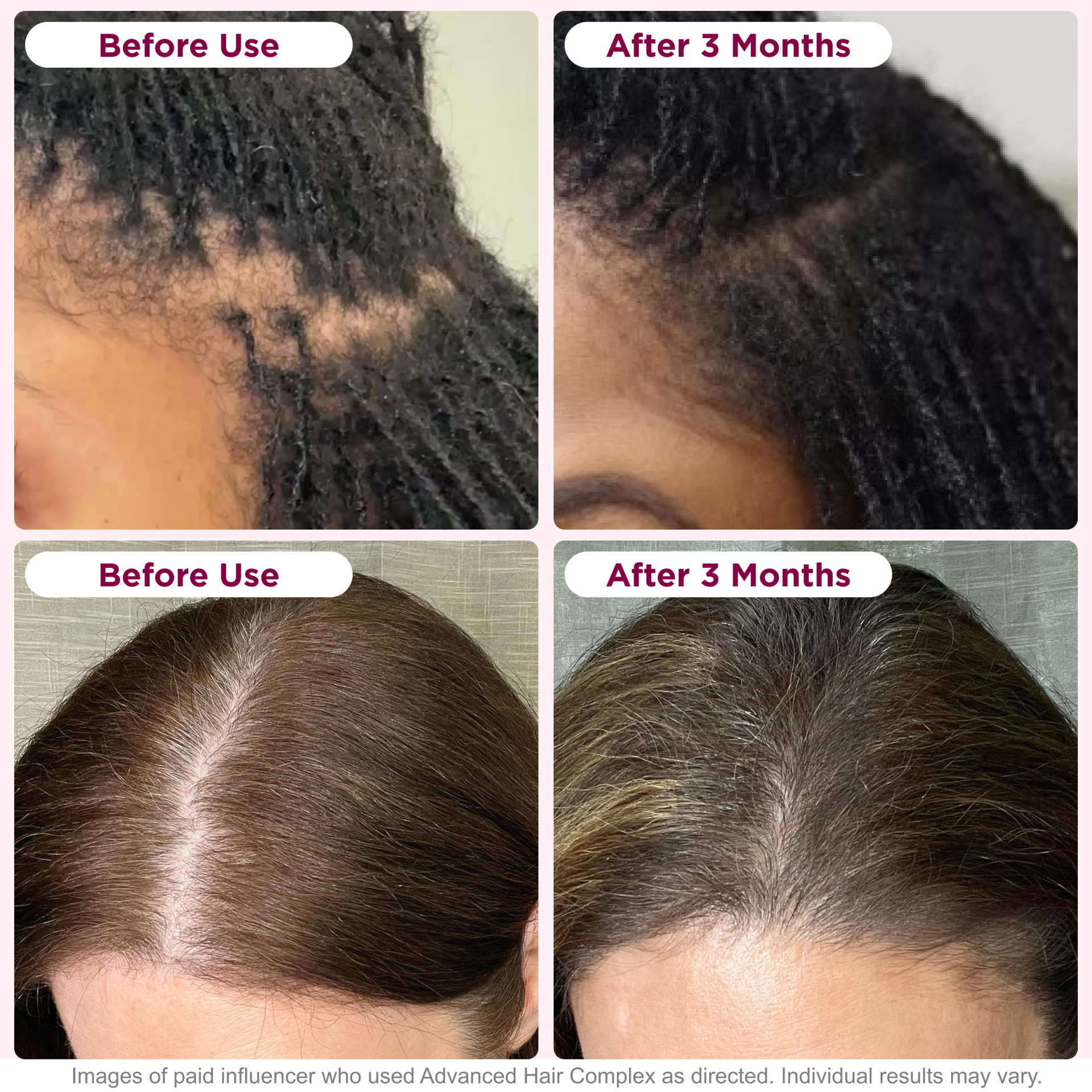 slide 2 of 5, Nature's Bounty Hair Growth Capsules, 30 ct