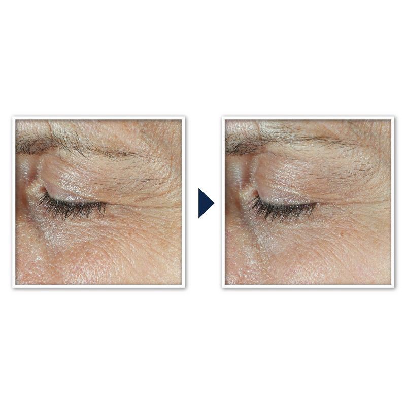 slide 5 of 7, RoC + Derm Correxion Advanced Retinol & Peptides Dual Eye Cream 2 - 0.34 fl oz Each, 2 ct