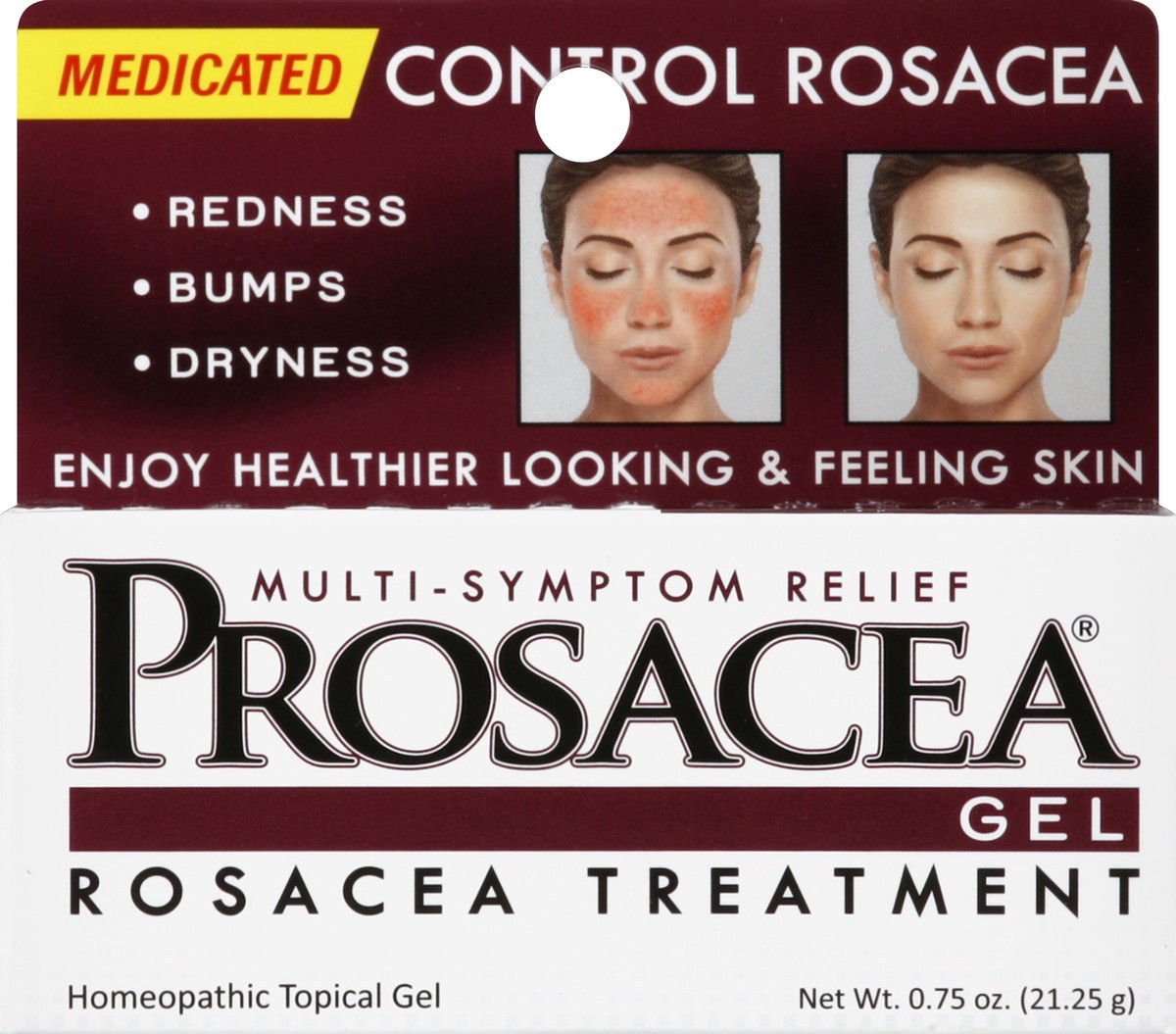 slide 4 of 7, Prosacea Rosacea Treatment, Homeopathic Topical Gel, 0.75 oz