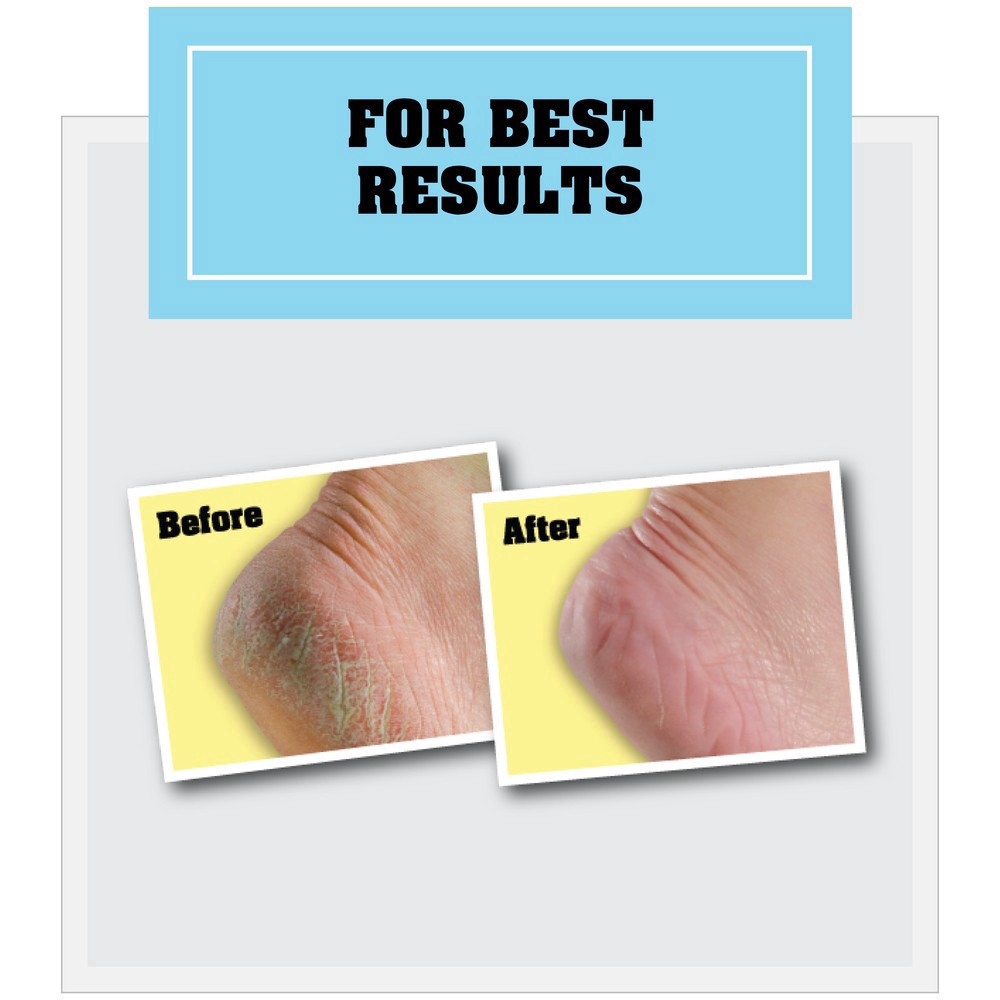 slide 7 of 9, O'Keeffe's Foot Cream 2.7 oz, 2.7 oz