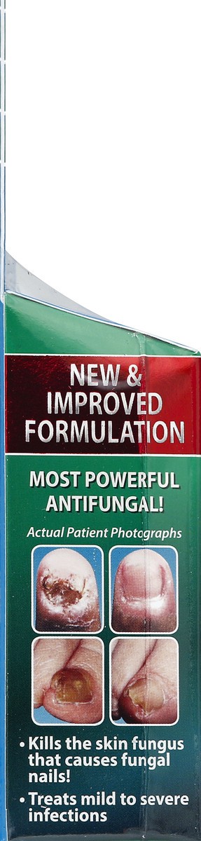 slide 3 of 7, Tineacide Antifungal Cream 1.25 oz, 1.25 oz