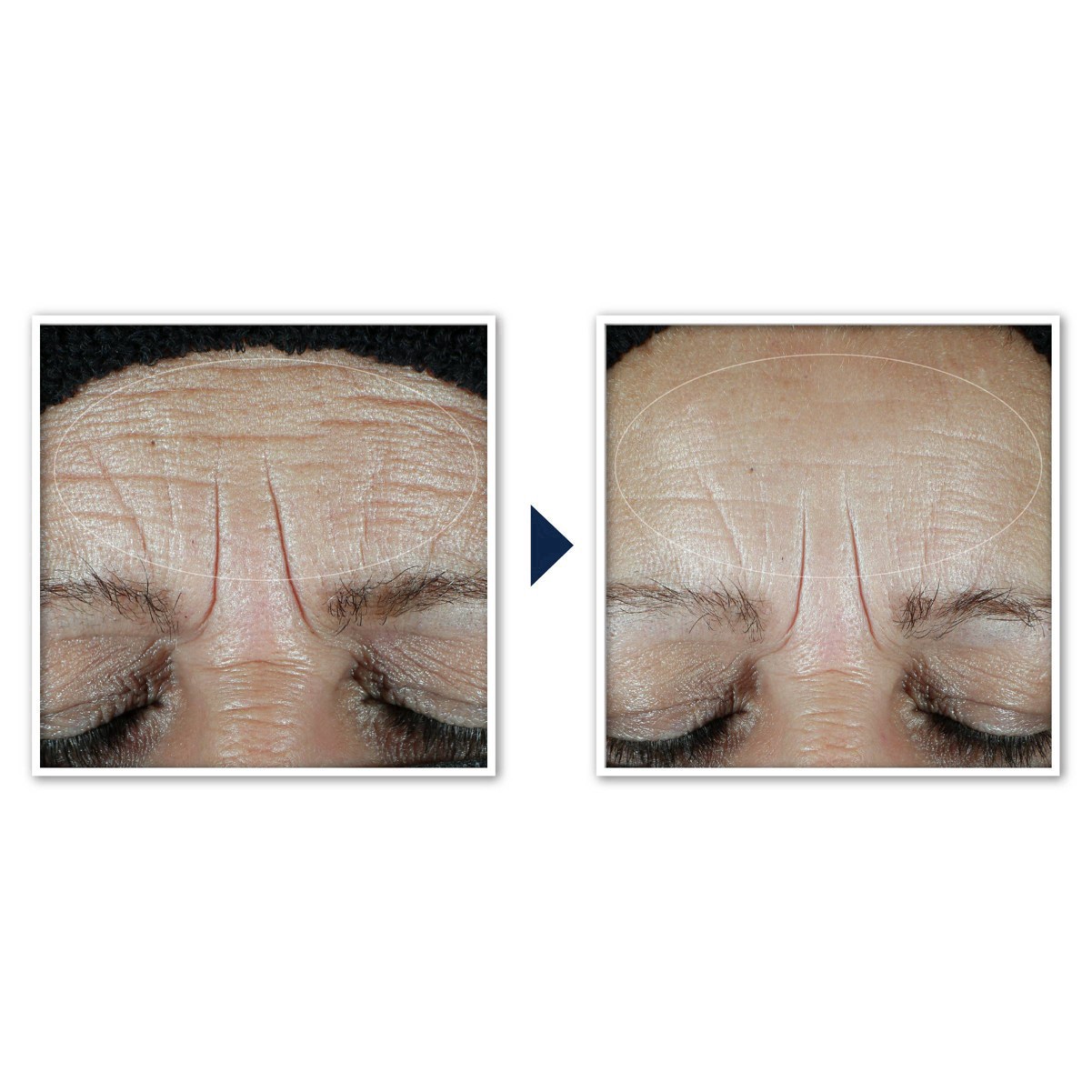 slide 66 of 91, RoC Hydration+ Sunscreen SPF 30 Moisturizer 1.7 fl oz, 1.7 fl oz