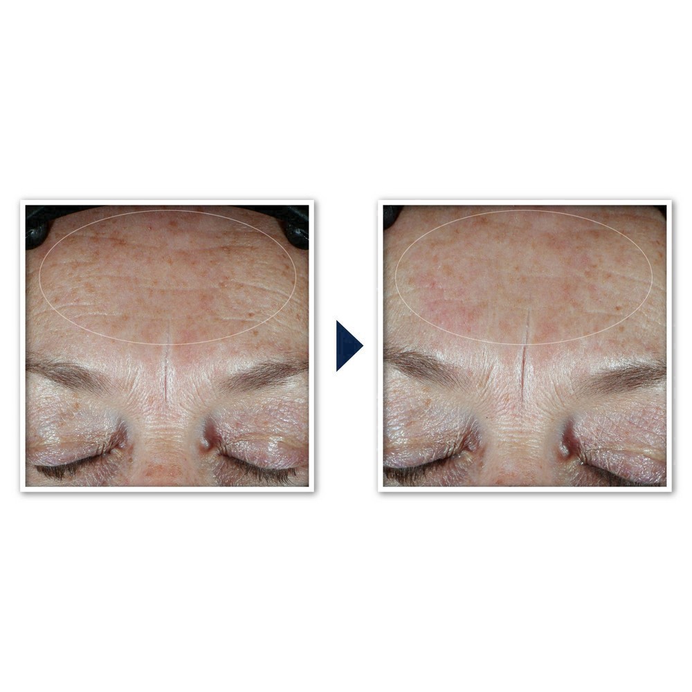 slide 13 of 91, RoC Hydration+ Sunscreen SPF 30 Moisturizer 1.7 fl oz, 1.7 fl oz