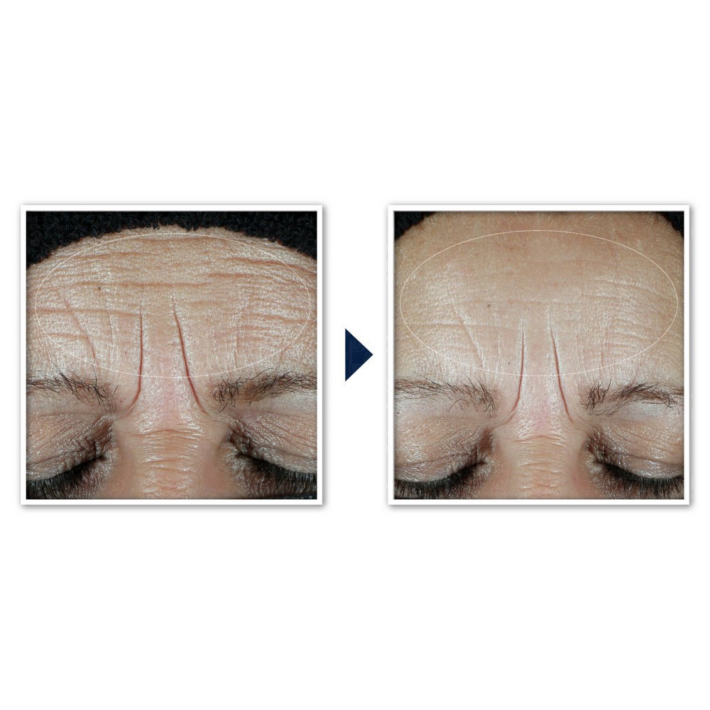 slide 8 of 91, RoC Hydration+ Sunscreen SPF 30 Moisturizer 1.7 fl oz, 1.7 fl oz