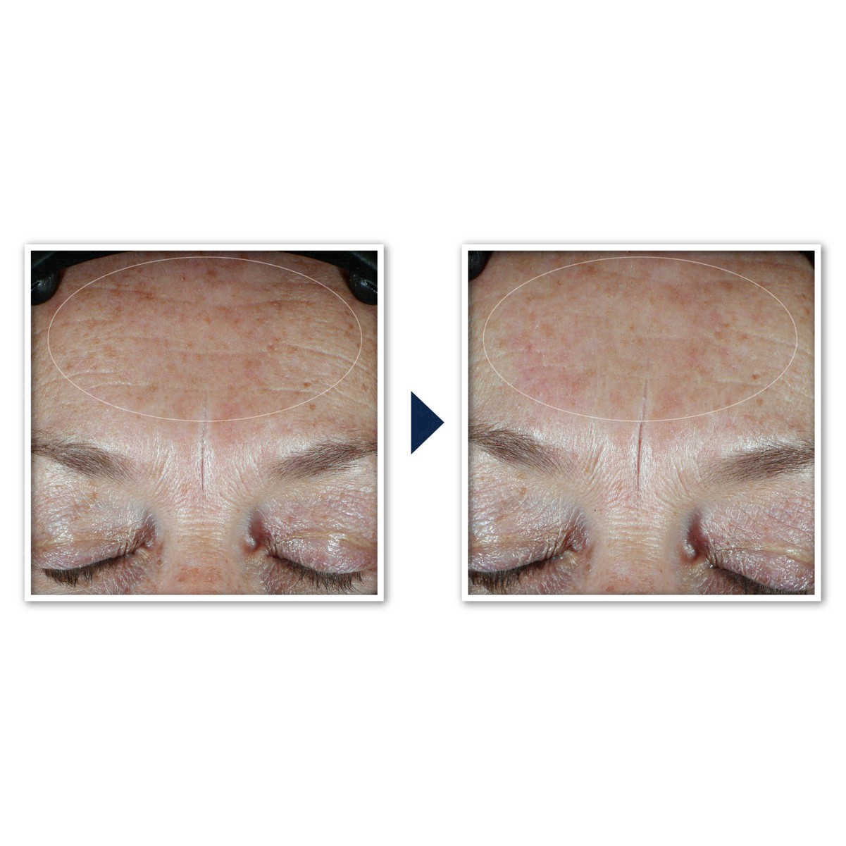 slide 10 of 91, RoC Hydration+ Sunscreen SPF 30 Moisturizer 1.7 fl oz, 1.7 fl oz