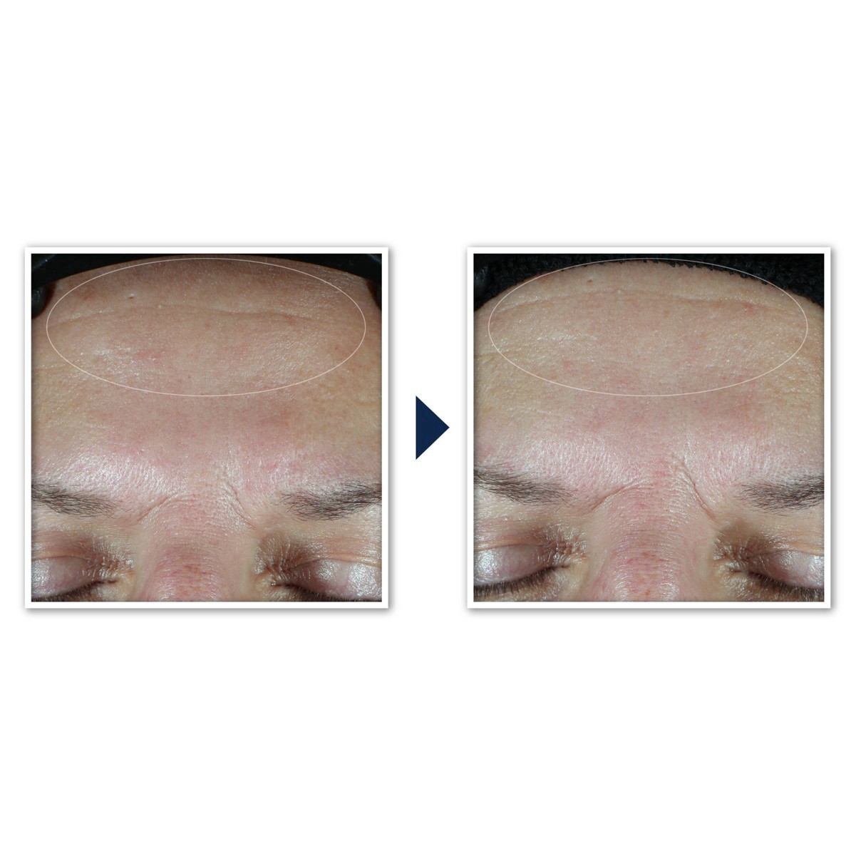 slide 18 of 91, RoC Hydration+ Sunscreen SPF 30 Moisturizer 1.7 fl oz, 1.7 fl oz