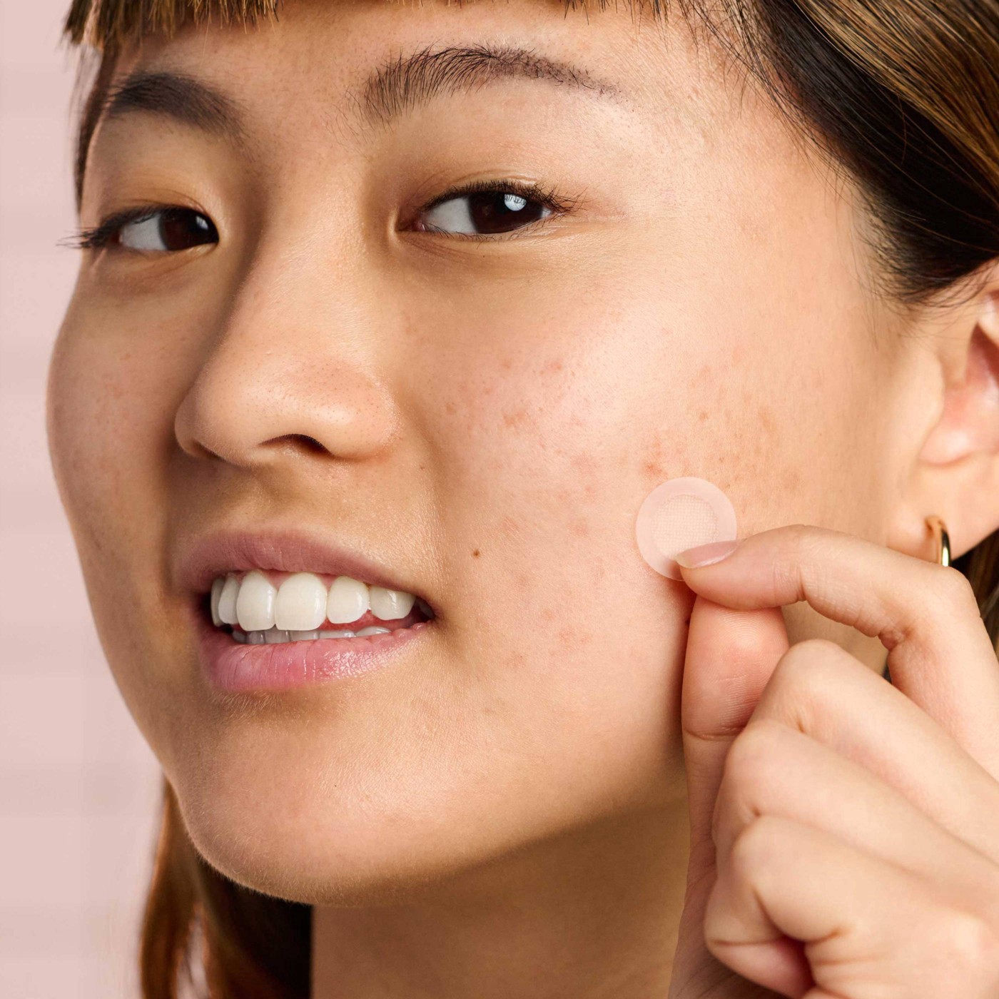 slide 9 of 11, Hero Cosmetics Mighty Acne Patch Micropoint for Dark Spots - 8 patches, 6 ct