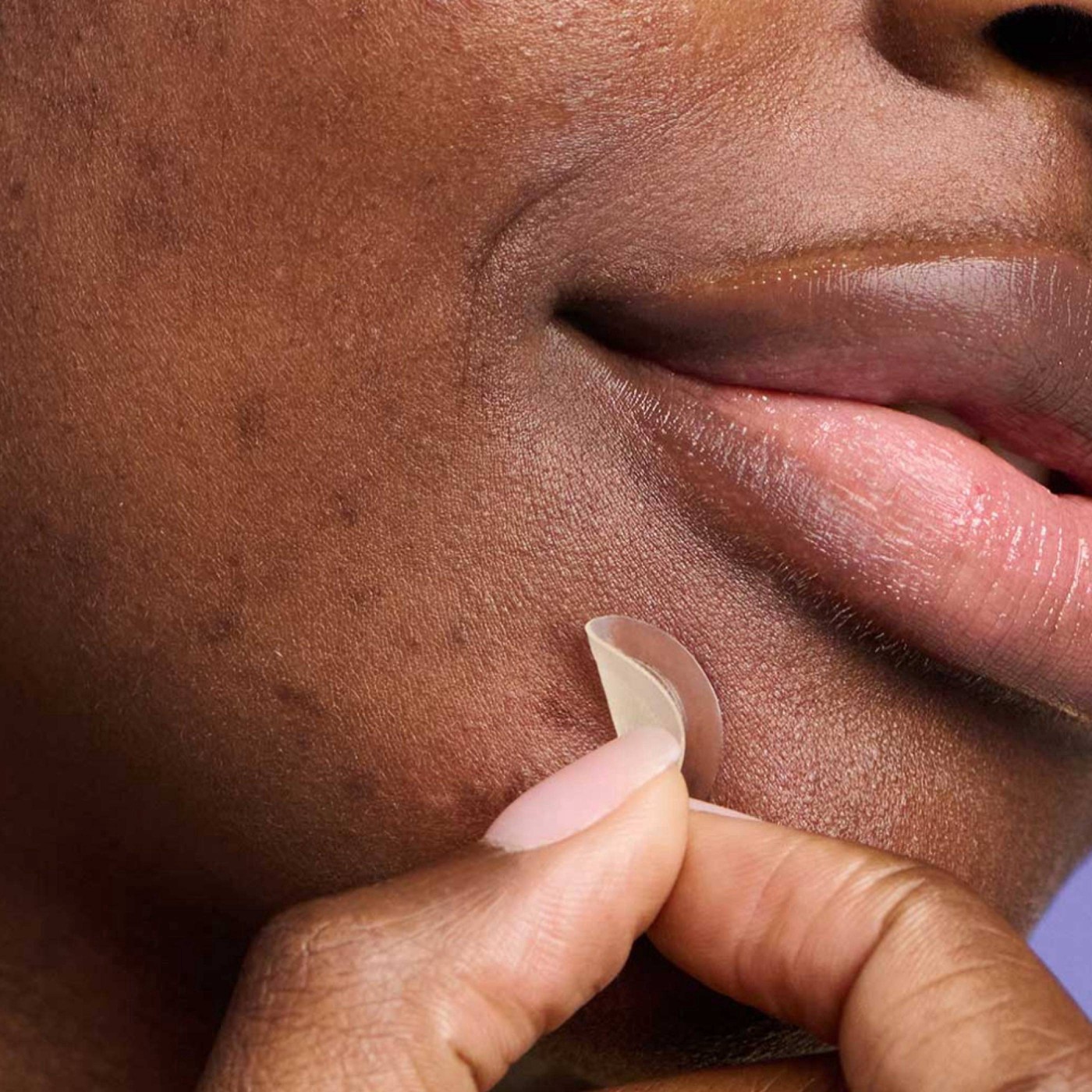 slide 5 of 11, Hero Cosmetics Mighty Acne Patch Micropoint for Dark Spots - 8 patches, 6 ct