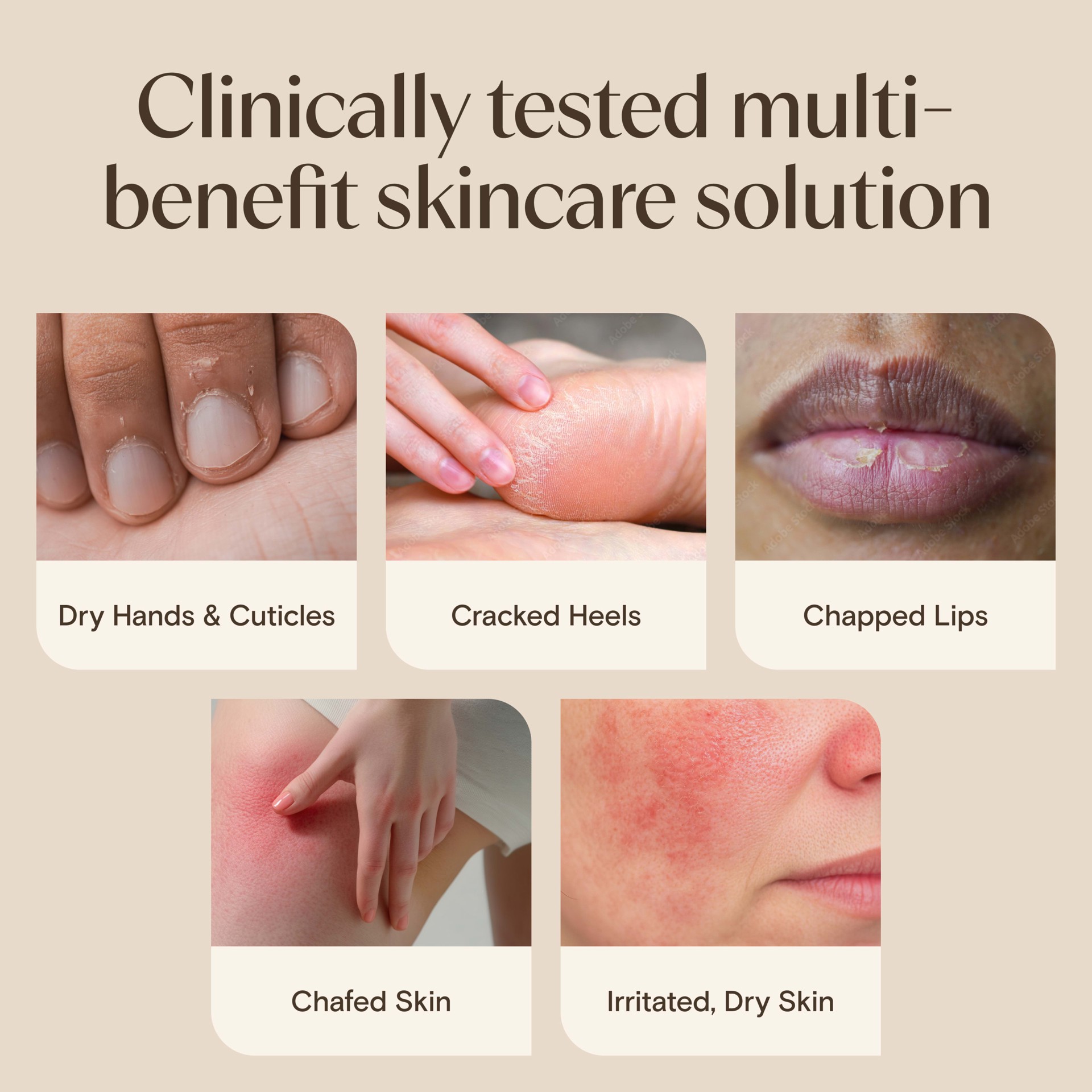 slide 9 of 9, Aveeno Skin Relief Healing Ointment, Fragrance-Free, 7.2 Oz, 7.2 oz