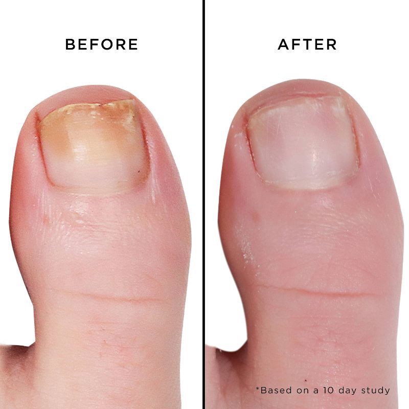 slide 3 of 3, Btr Lndn Mellow The Yellow Nl Treat, 0.2 oz