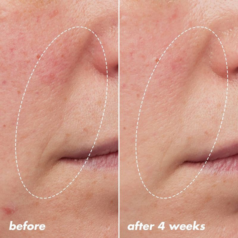 slide 5 of 14, e.l.f. Youth Boosting Blue-ty Sleep Night Oil Facial Treatment - 1 fl oz, 1 fl oz